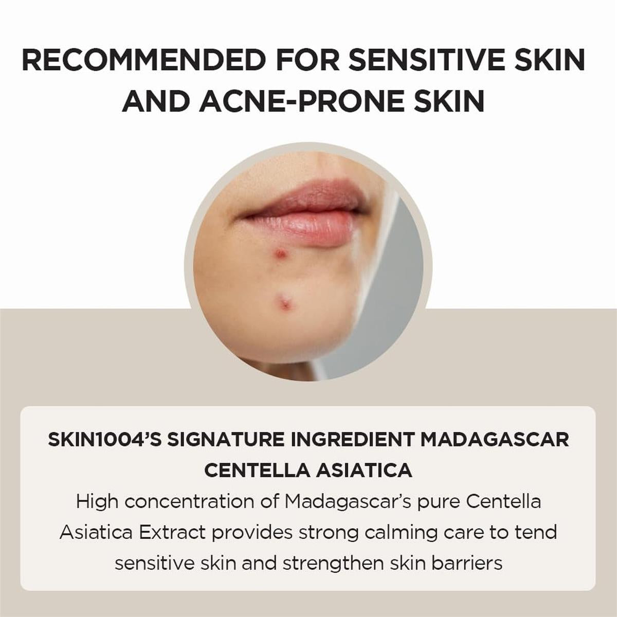 Skin1004, Centella Asiatica del Madagaskar 100 Ampullen (ml) / Gesichtsserum / 100% Centella Asiatica Extrakt/Beruhigende Haut für empfindliche und zu Akne neigende Haut